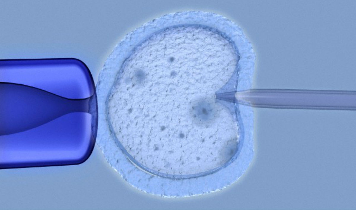 Malattie genetiche e gravidanza, Italia e Svizzera promuovono la diagnosi preimpianto