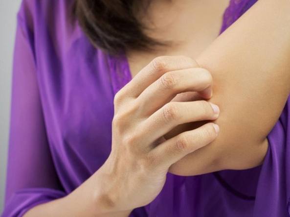 Oltre 235mila laziali affetti da psoriasi, malattia trascurata
