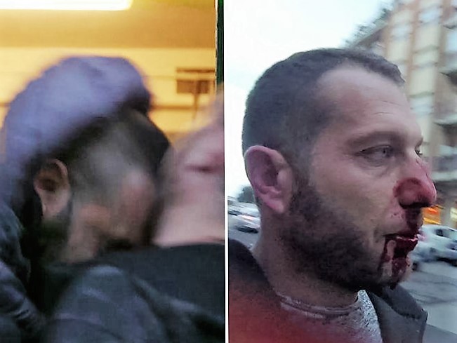 Ostia, Di Stefano (CasaPound): “Da Roberto Spada violenza gratuita allucinante” [VIDEO]