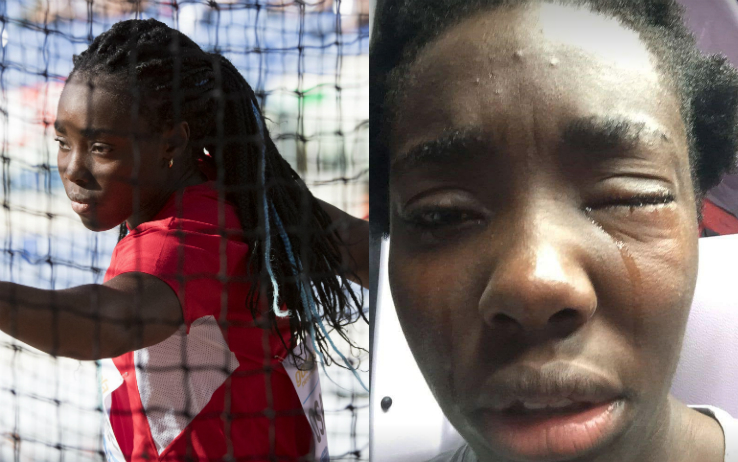 Targato Pd l’uovo che ha colpito Daisy Osakue, chi sono i veri razzisti?