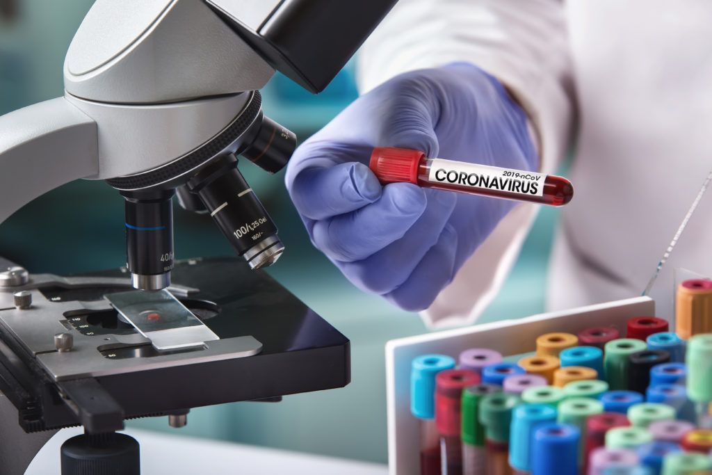 CORONAVIRUS | Parla il genetista: “Siamo rimasti impreparati per la rapidità di diffusione”