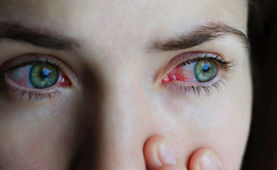 Glaucoma, ecco le nuove terapie
