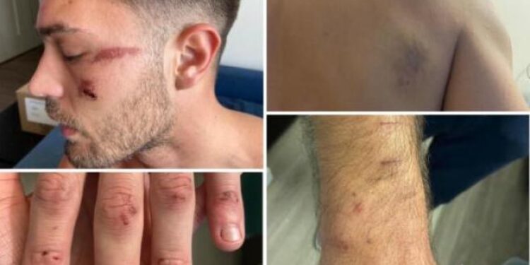 USA | L’italiano Matteo Falcinelli incaprettato dalla polizia: non ci sarà mai nessun processo