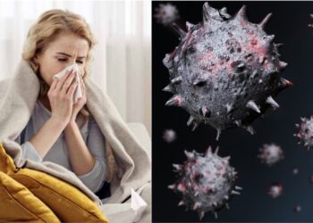 Influenza Australiana