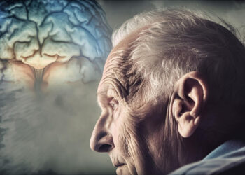 Alzheimer