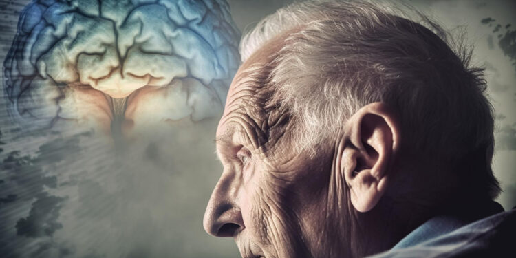 Alzheimer