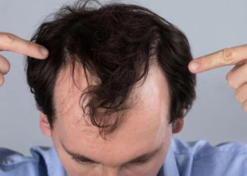 Caduta dei capelli